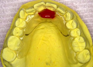 見えないおしゃぶり