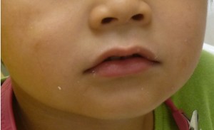 %e3%81%8a%e5%8f%a3tpc2%e6%9c%88